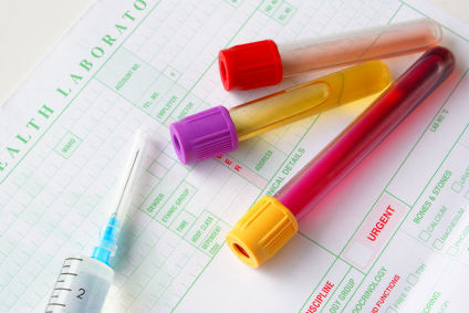 how often should we have STD check 